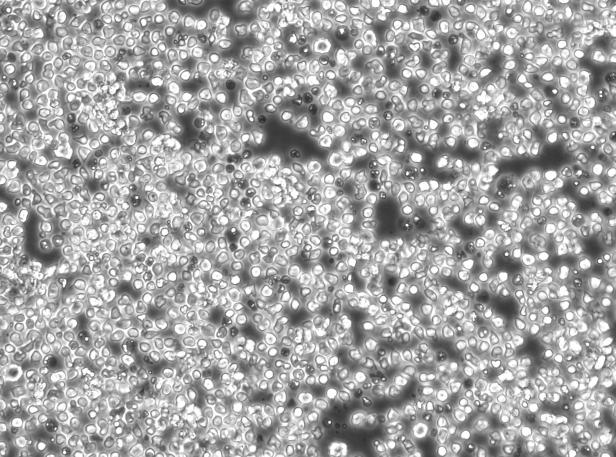 OriCell<sup>®</sup>Jurkat clone A3人T淋巴细胞白血病细胞系