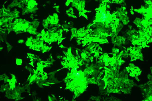 None OriCell<sup>®</sup>NCI-H295R with GFP H4-1203