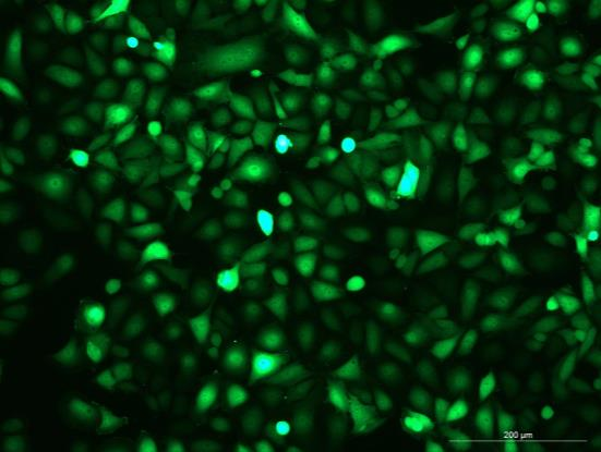 None OriCell<sup>®</sup>T24 with Luciferase & GFP H4-1005