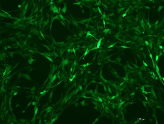 OriCell<sup>®</sup>YUMM1.7 with GFP