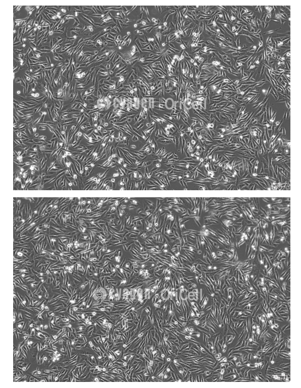 MDA-MB-231细胞培养