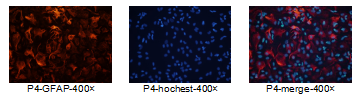 GFAP染色阳性，Hochest复染细胞核阳性，2组染色结果表明该细胞诱导后为星形胶质细胞 | 赛业OriCell