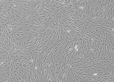 成人脂肪间充质干细胞 成人脂肪间充质干细胞 HUXMD-01001