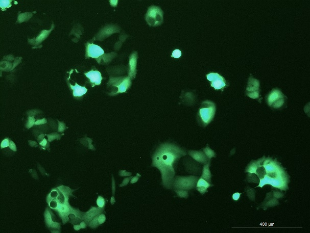 OriCell<sup>®</sup>MCF-7 with GFP