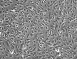 人脐静脉内皮细胞