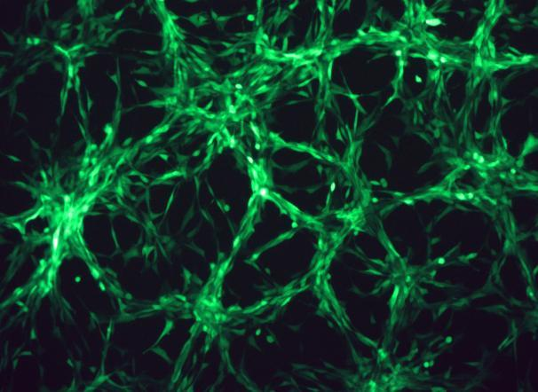 None OriCell<sup>®</sup>U-87 MG with Luciferase & GFP H8-0505