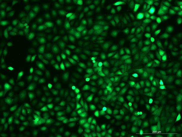 OriCell<sup>®</sup>5637 with Luciferase & GFP
