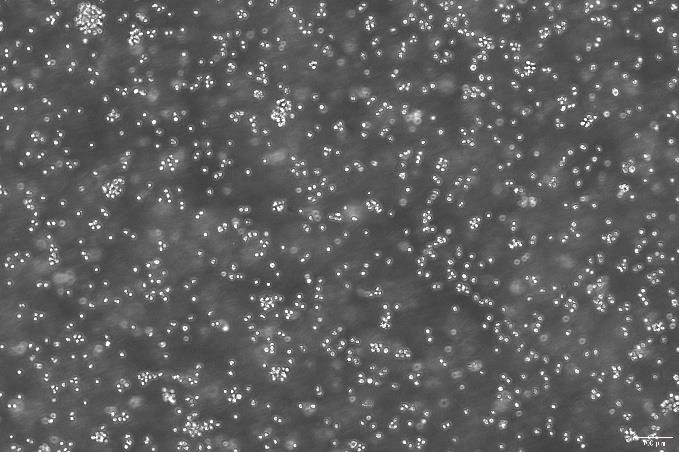 OriCell<sup>®</sup>NAMALWA 人 Burkitt's 淋巴瘤细胞系