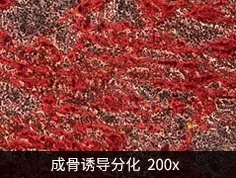 骨髓间充质干细胞的成骨分化诱导
