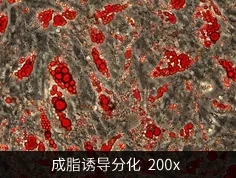 骨髓间充质干细胞的成脂分化诱导