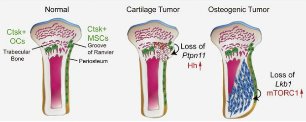 “少年杀手”骨肉瘤的新细胞起源以及STK11/LKB1对骨癌的发病影响