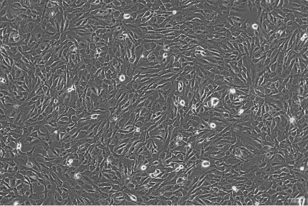 OriCell<sup>®</sup>12Z 人子宫内膜异位上皮细胞永生化细胞系