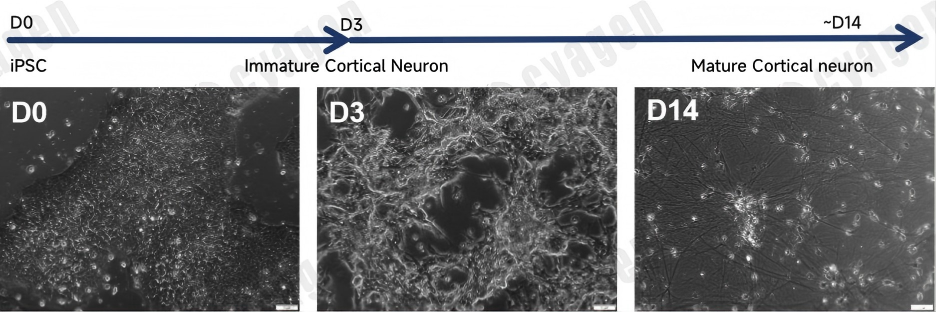iPSC来源皮质神经元模型