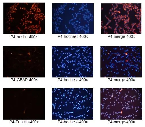 神经干细胞免疫荧光染色鉴定 | 赛业OriCell