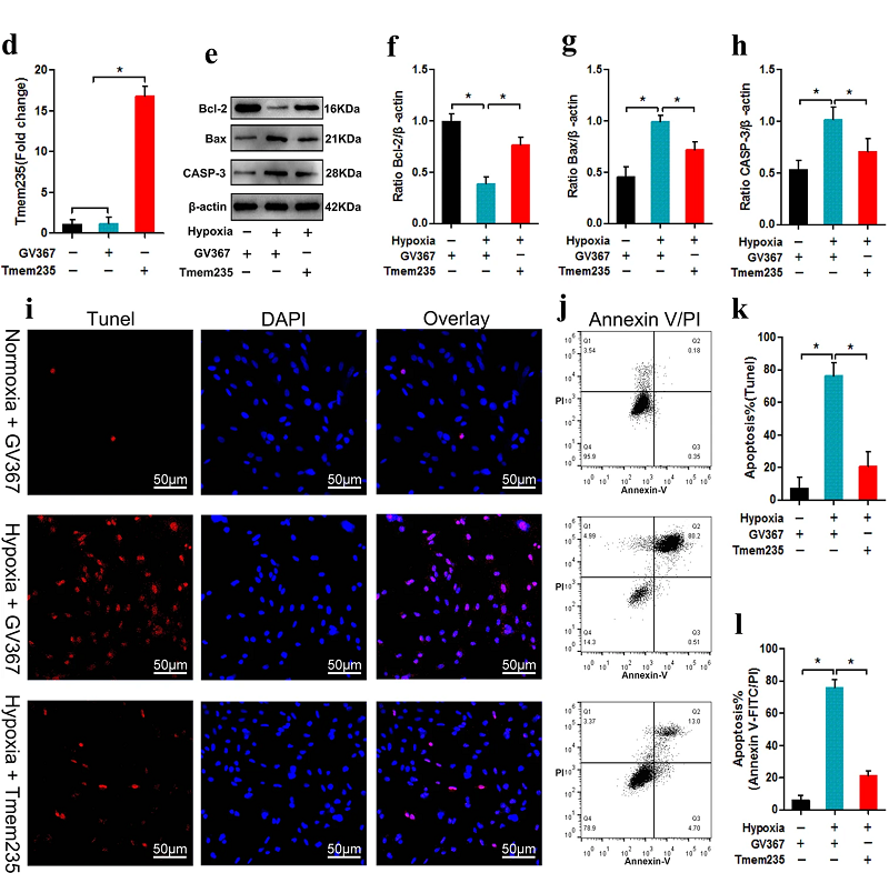 LncRNA Tmem235调控BMSC缺氧性凋亡促进激素性股骨头坏死修复
