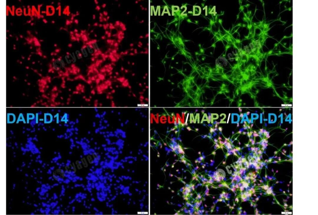 iPSC来源皮质神经元模型