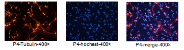 Tubulin染色阳性，Hochest复染细胞核阳性，2组染色结果表明该细胞诱导后为神经元细胞。 | 赛业OriCell