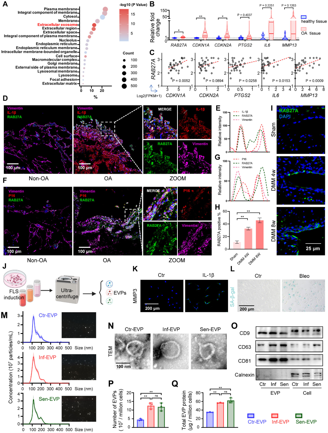 骨关节炎新疗法