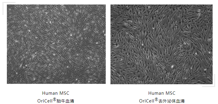 Human MSC  OriCell®胎牛血清培养干细胞状态对比图