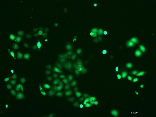 OriCell<sup>®</sup>5637 with Luciferase & GFP