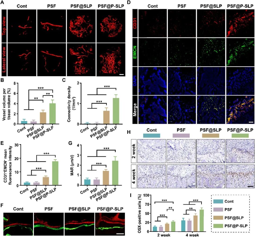 抗氧化—血管-成骨偶联
