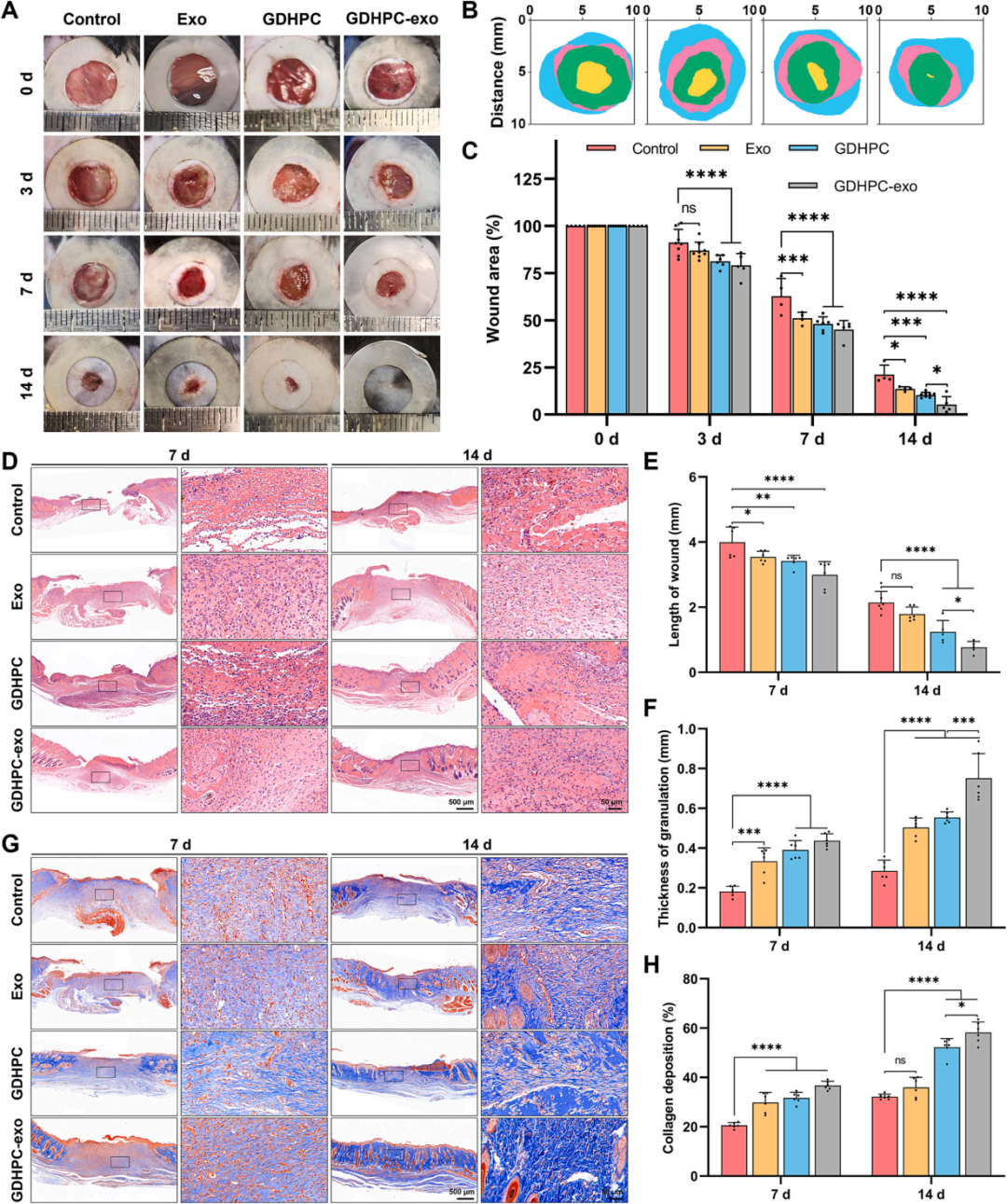 治疗糖尿病创面新策略