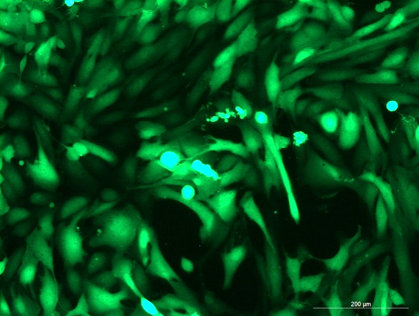 None OriCell<sup>®</sup>786-O with Luciferase & GFP H4-0405