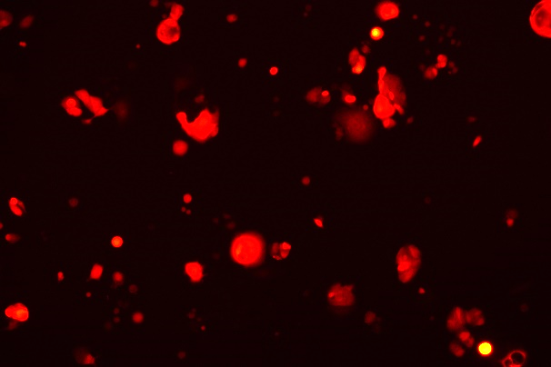 None OriCell<sup>®</sup>ASPC-1 with RFP H2-0904