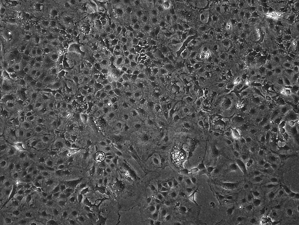 Caco-2 人结直肠腺癌细胞系