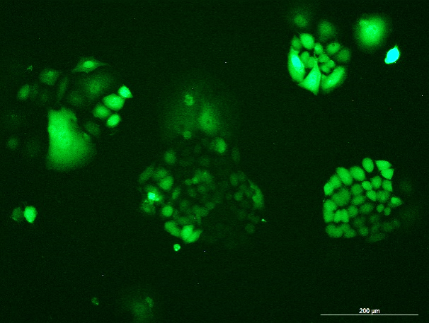 None OriCell<sup>®</sup>HCT-15 with Luciferase & GFP H1-2905