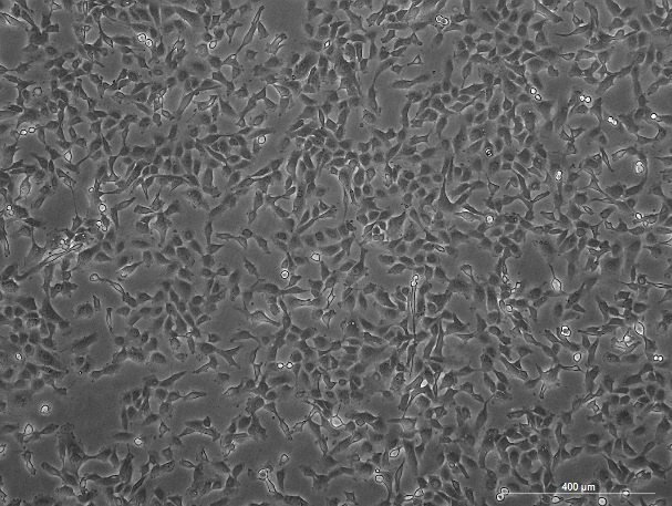 OriCell<sup>®</sup>HT-1080人纤维肉瘤细胞系