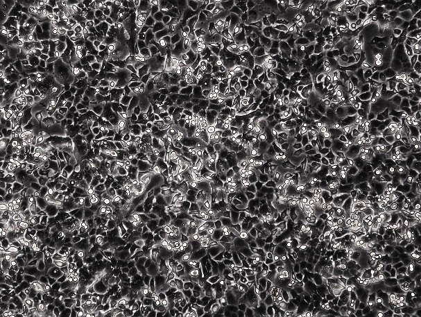 Hela 人宫颈癌细胞系