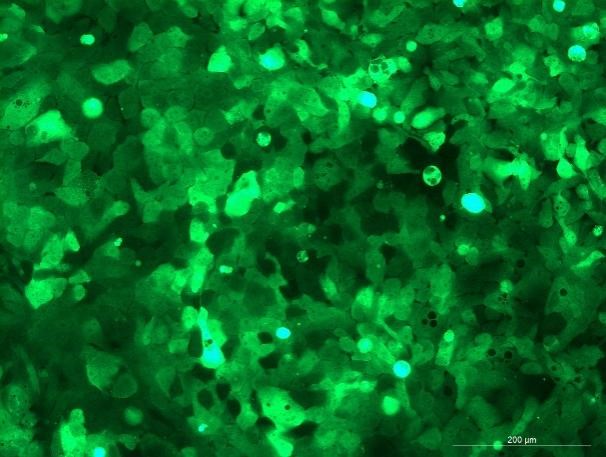 None OriCell<sup>®</sup>KYSE-150 with Luciferase & GFP H1-1505