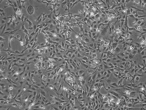 OriCell<sup>®</sup>LX-2 人肝星形细胞系