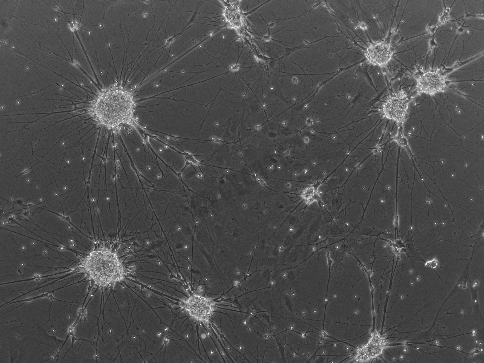 iPSC-MN（运动神经元细胞）