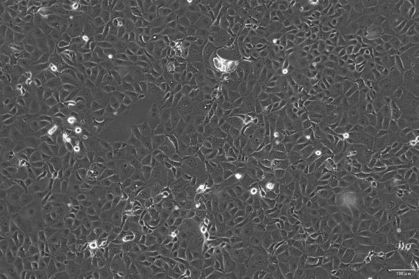 OriCell<sup>®</sup>NCI-H1693 人肺腺癌细胞系