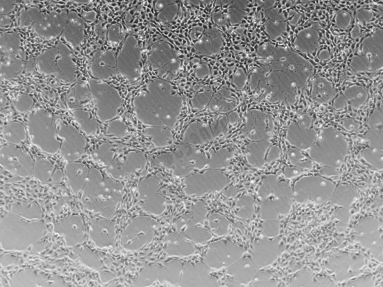 iPSC-NPC（神经祖细胞）