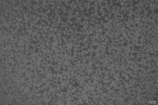 OriCell<sup>®</sup>MDA-kb2 人乳腺癌细胞系