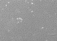 Wistar大鼠脂肪间充质干细胞 Wistar大鼠脂肪间充质干细胞 RAWMD-01001