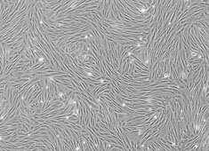 兔脂肪间充质干细胞 兔脂肪间充质干细胞 RBXMD-01001