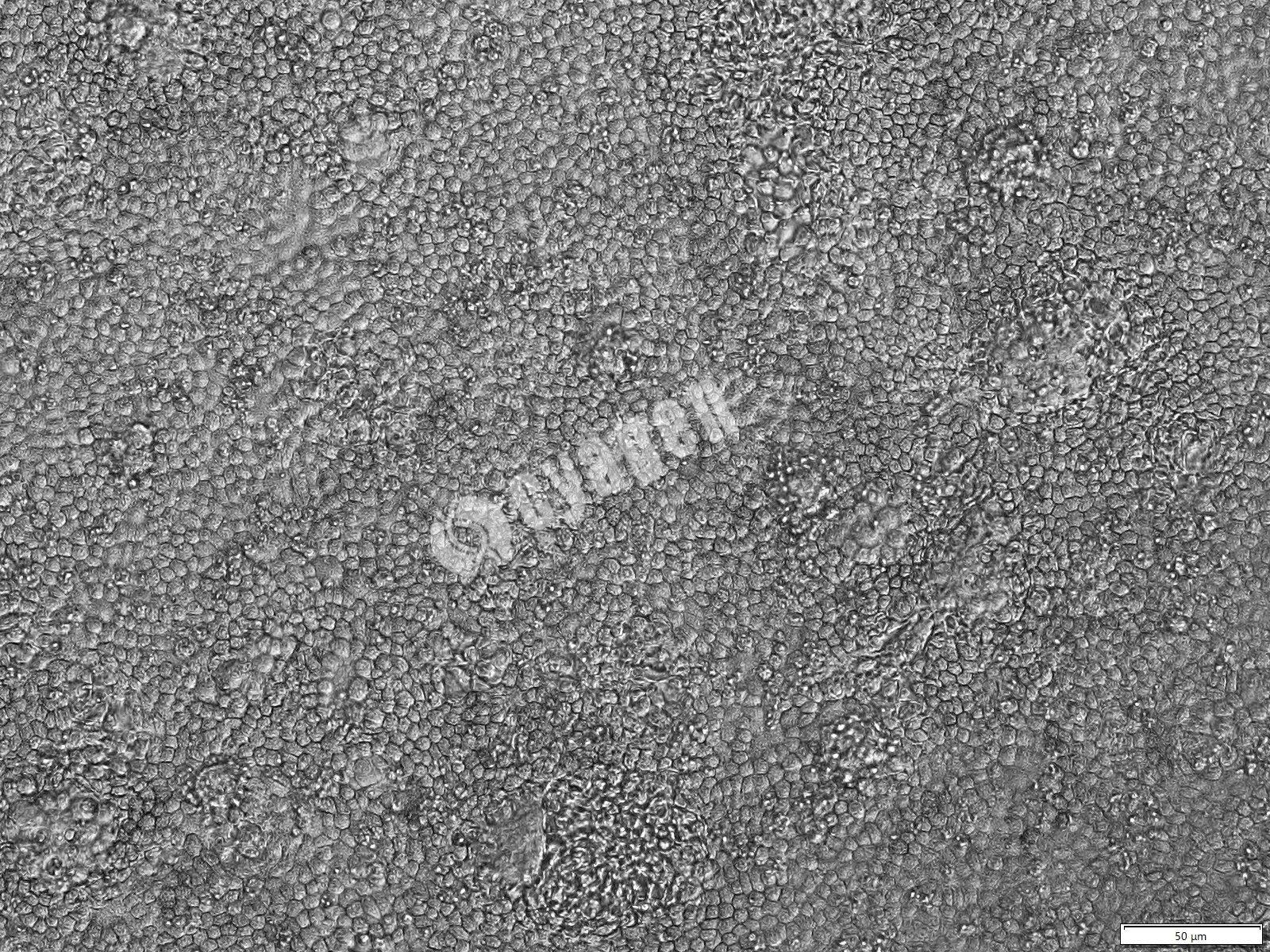 iPSC-RPE（视网膜色素上皮细胞）