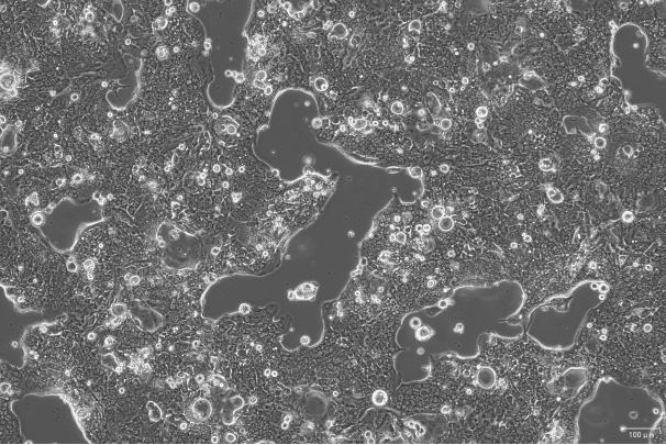 OriCell<sup>®</sup>SW1417 人结肠直肠腺癌细胞系