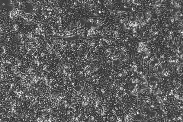 OriCell<sup>®</sup>SW756 人子宫鳞状癌细胞系