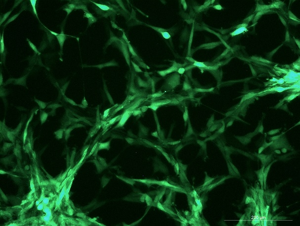 None OriCell<sup>®</sup>U-87 MG with Luciferase & GFP H8-0505