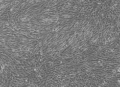 人脐血间充质干细胞 人脐血间充质干细胞 HUXUB-01001