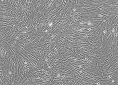 人脐带间充质干细胞 人脐带间充质干细胞 HUXUC-01001